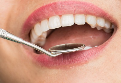 虫歯や歯周病、入れ歯などを中心とした一般歯科